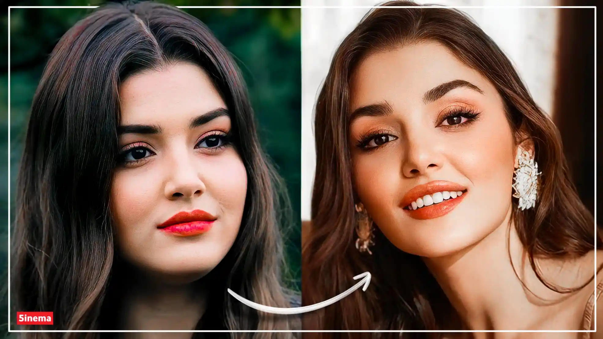 Hande Erçel Before and After Plastic Surgery